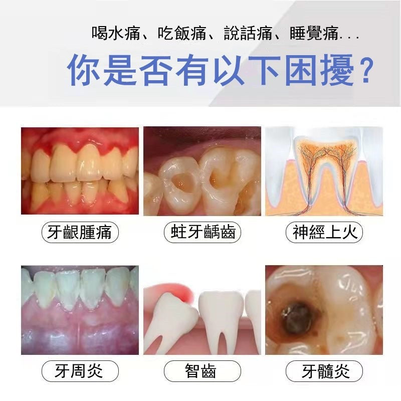 牙齒疼痛牙齦腫痛 噴劑牙痛寧噴劑速效去牙痛消炎蛀牙智